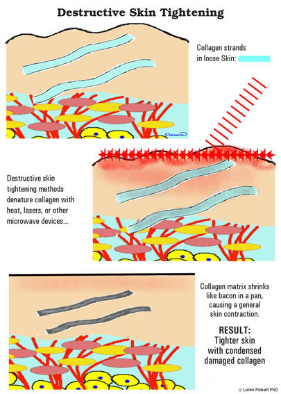 What to Use After Dermabrasion